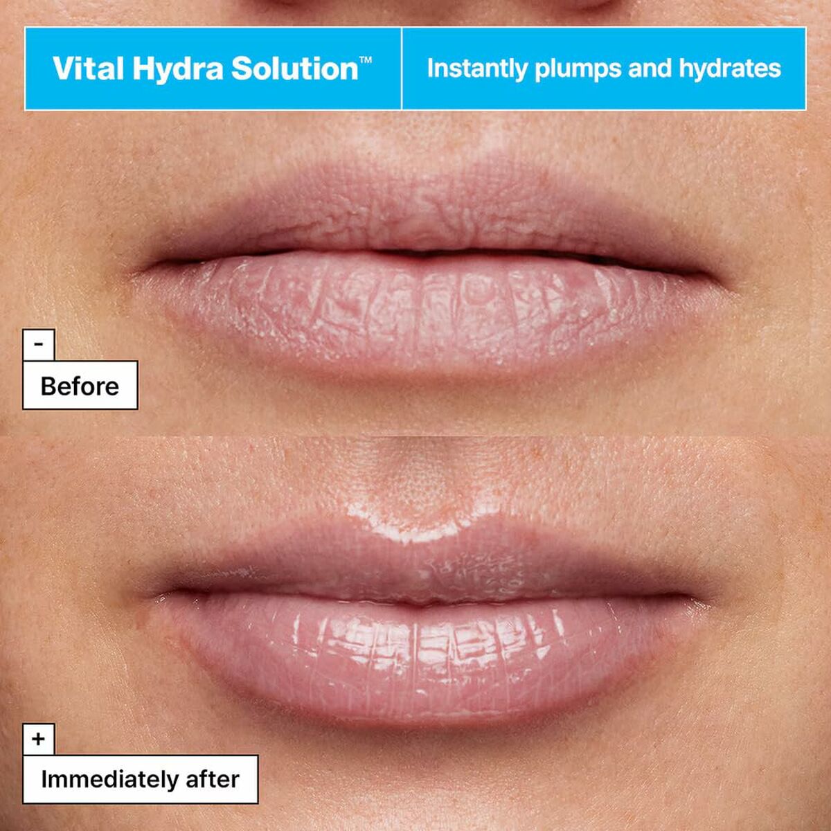Comparison of lips before and after using DR.JART+ Vital Hydra Solution lip balm, showing plumpness and hydration.