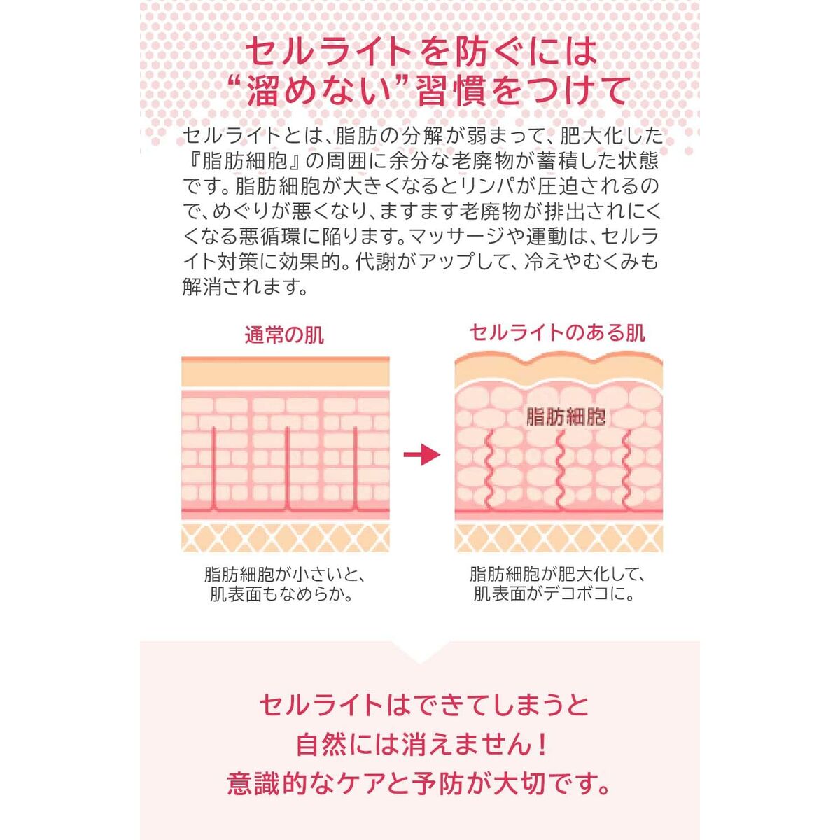 Infographic explaining cellulite prevention with tips for maintaining skin health and hydration.