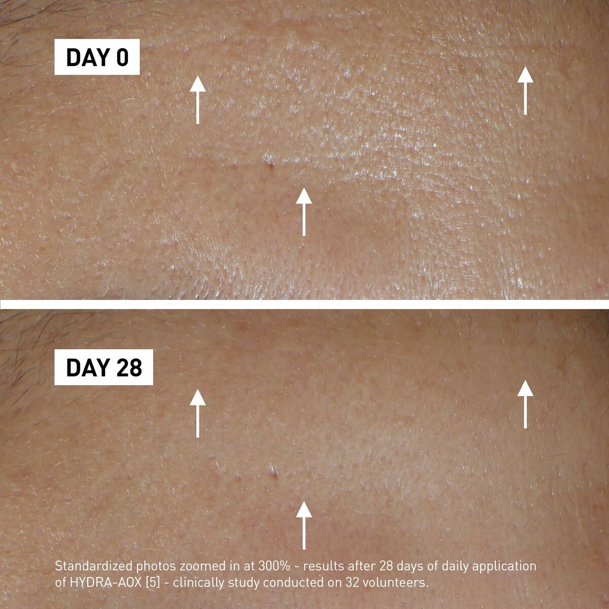 Before and after results of skin after 28 days using Filorga Crème de jour, showing improved texture.
