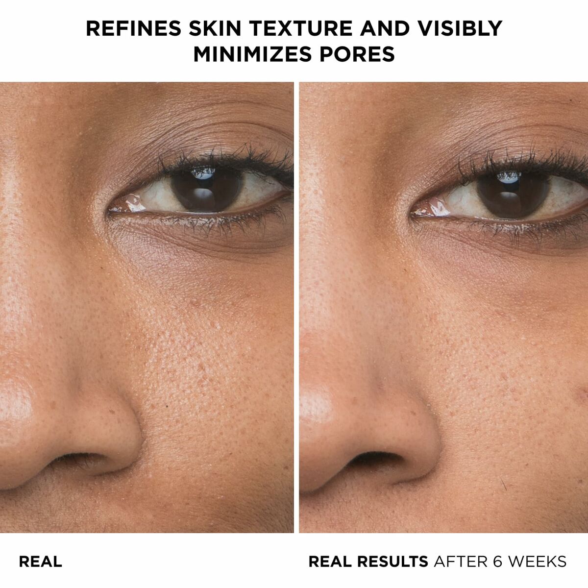Before and after images showing refined skin texture and minimized pores after using It Cosmetics Bye Bye Pores.