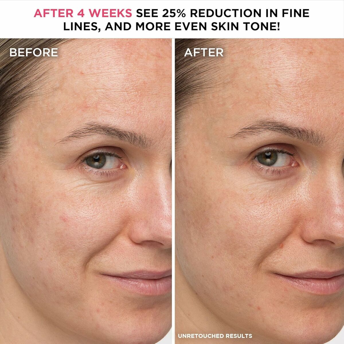 Before and after results showing 25% reduction in fine lines and more even skin tone after 4 weeks of using skincare.